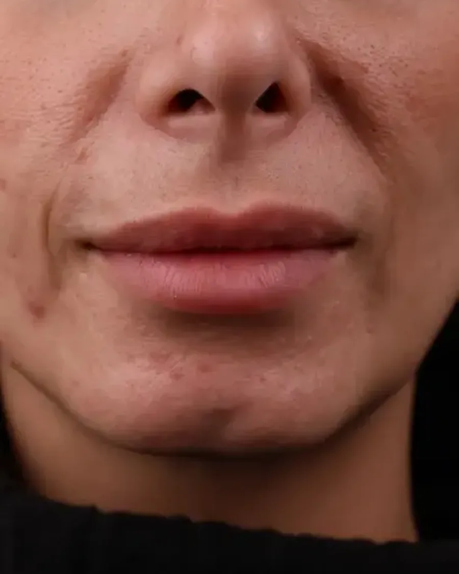 Aesthetic treatment detail, American Aesthetic Medical Center