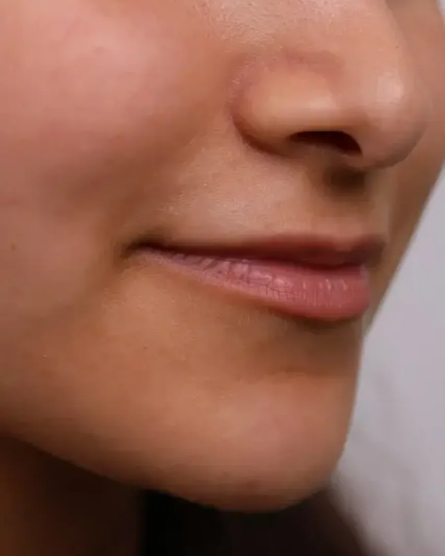 Aesthetic treatment detail, American Aesthetic Medical Center